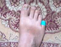 my_foot02.jpg