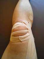 my_left_knee_20150621_2.jpg